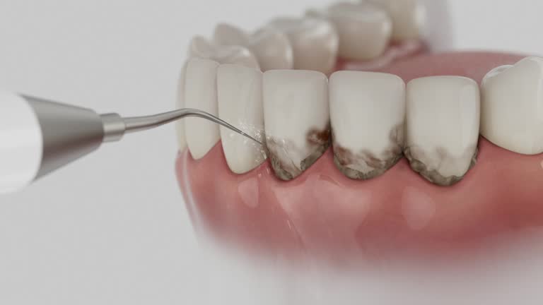 Reliable Tooth Extraction contractor in Eagle Lake, TX by Smile Center Dentistry